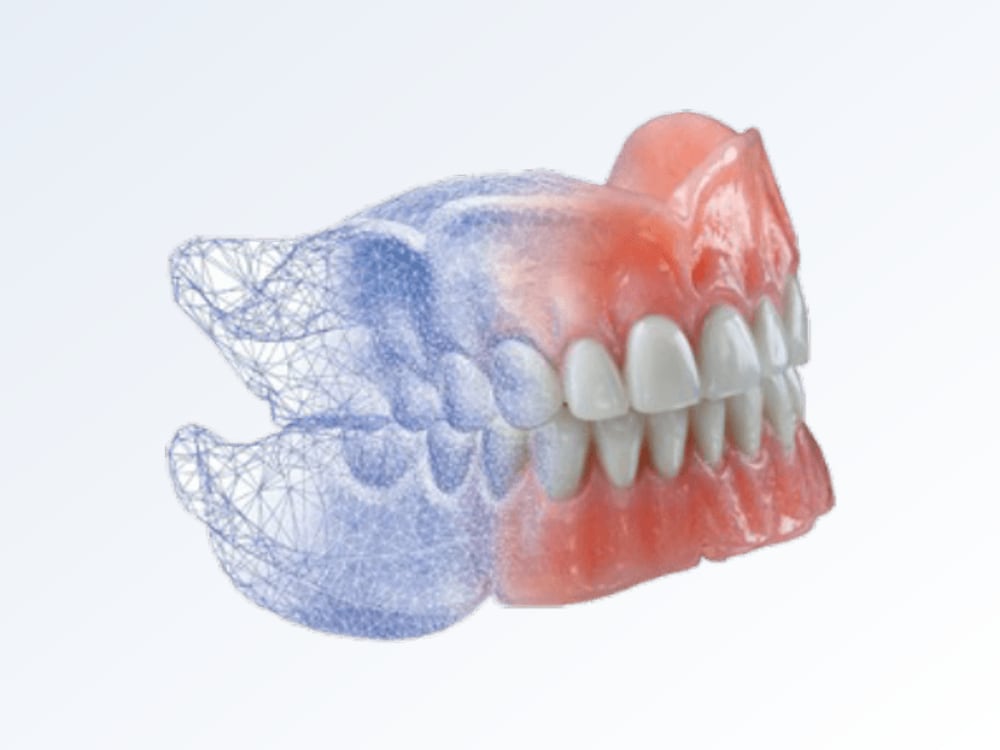 Digital Dentures