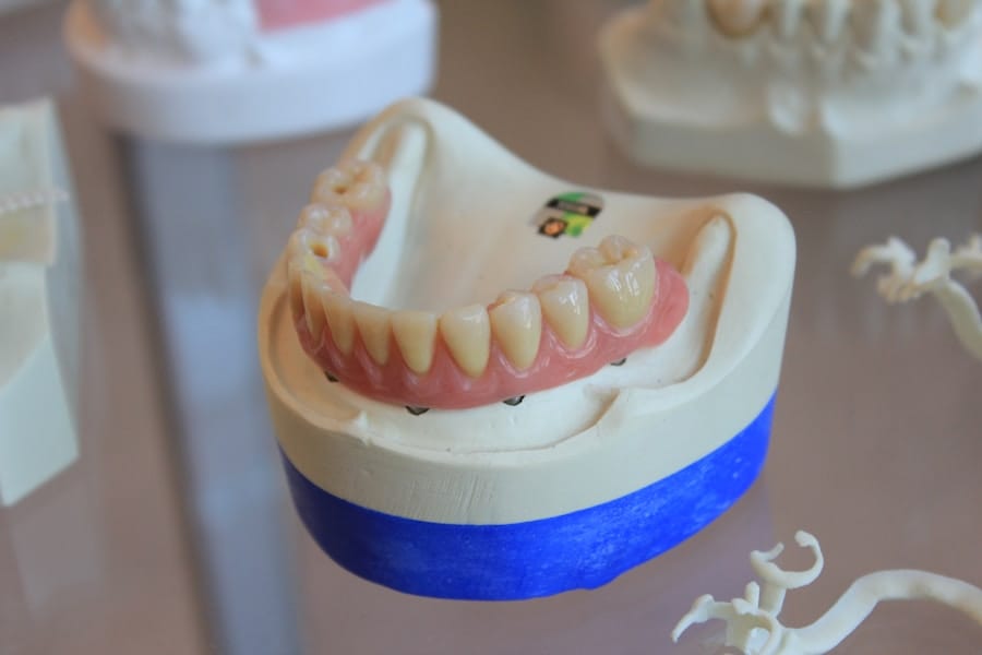 Immediate Dentures