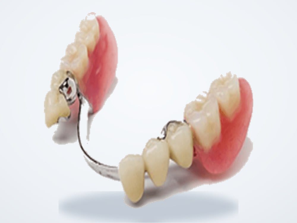 Partial Dentures