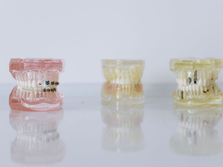Sports Mouth Guards
